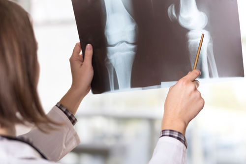 Knee Injuries Knee Injuries