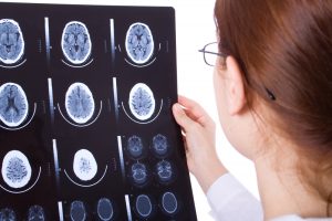 East Meadow Brain Injury Accidents