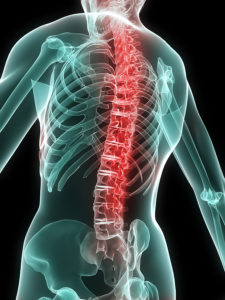 Brooklyn Spinal Cord Injuries
